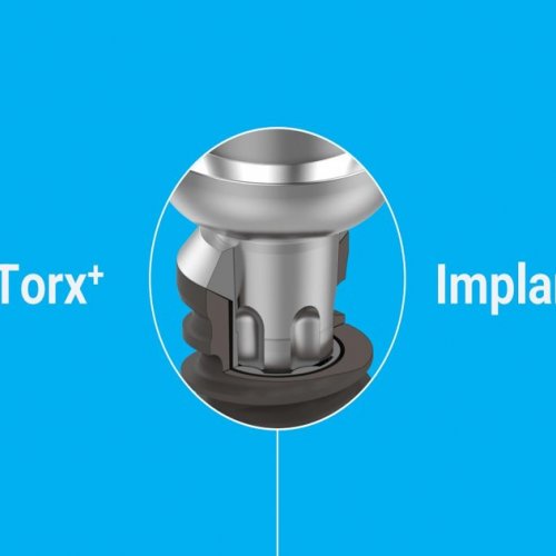 Dental Implant (Fixture, Abutment, Surgery Kit)