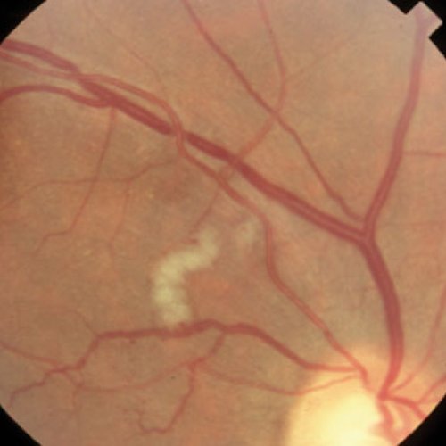 Advanced medical device software using AI to analyze blood vessel shapes