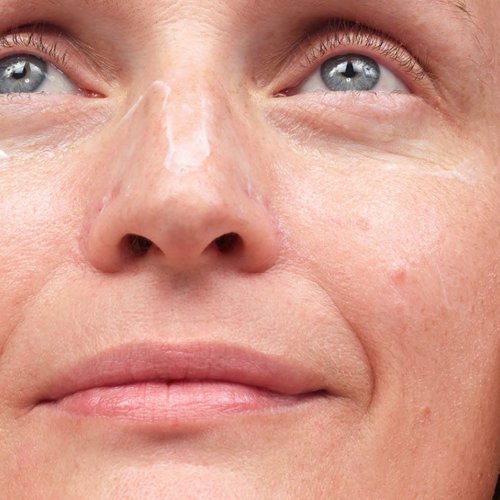 ETC and OTC treatments for skin diseases