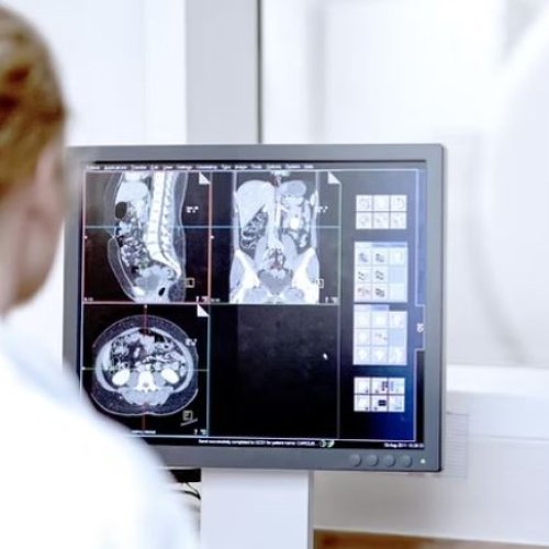 Therapeutic Devices